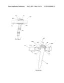 Polyaxial Plate Rod System and Surgical Procedure diagram and image