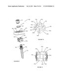 Polyaxial Plate Rod System and Surgical Procedure diagram and image