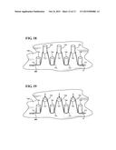 METHOD OF MANUFACTURING A DEPLOYMENT HANDLE OF A MEDICAL DEVICE DEPLOYMENT     SYSTEM diagram and image