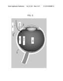 ADJUSTABLE LOOP FIBER OPTIC ILLUMINATION DEVICE FOR SURGERY diagram and image