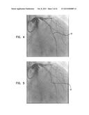 AUTOMATIC REDUCTION OF VISIBILITY OF PORTIONS OF AN IMAGE diagram and image