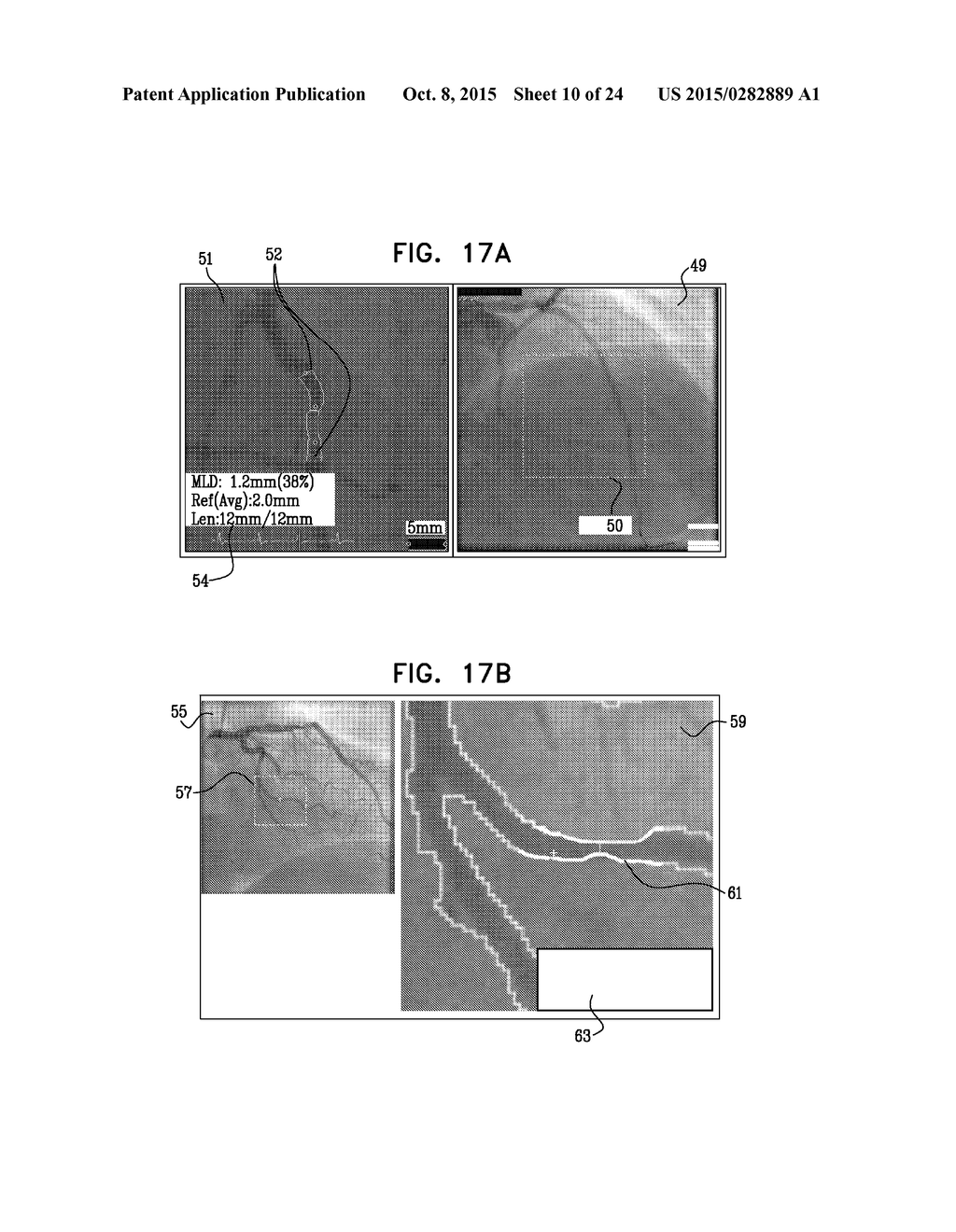 AUTOMATIC REDUCTION OF VISIBILITY OF PORTIONS OF AN IMAGE - diagram, schematic, and image 11