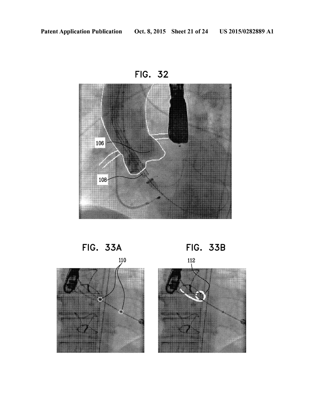 AUTOMATIC REDUCTION OF VISIBILITY OF PORTIONS OF AN IMAGE - diagram, schematic, and image 22