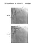 IDENTIFICATION AND PRESENTATION OF DEVICE-TO-VESSEL RELATIVE MOTION diagram and image