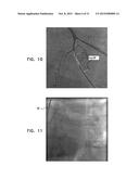 IDENTIFICATION AND PRESENTATION OF DEVICE-TO-VESSEL RELATIVE MOTION diagram and image