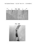 IDENTIFICATION AND PRESENTATION OF DEVICE-TO-VESSEL RELATIVE MOTION diagram and image