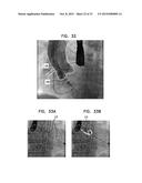 IDENTIFICATION AND PRESENTATION OF DEVICE-TO-VESSEL RELATIVE MOTION diagram and image