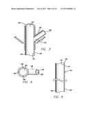 SELF-ILLUMINATING ENDOGASTRIC TUBES AND METHOD OF PLACING ENDOGASTRIC     TUBES diagram and image