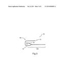 Apparatus for Applying Corrective Forces to Shape Palate diagram and image