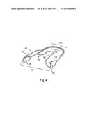 Apparatus for Applying Corrective Forces to Shape Palate diagram and image