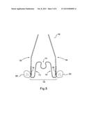 Apparatus for Applying Corrective Forces to Shape Palate diagram and image