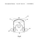 Apparatus for Applying Corrective Forces to Shape Palate diagram and image