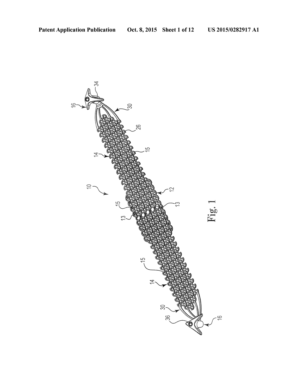 Patterned Sling Implant and Method - diagram, schematic, and image 02
