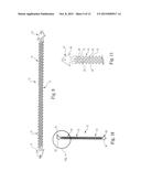 Patterned Sling Implant and Method diagram and image