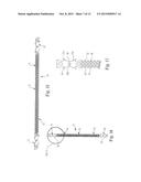 Patterned Sling Implant and Method diagram and image