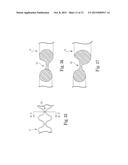 Patterned Sling Implant and Method diagram and image