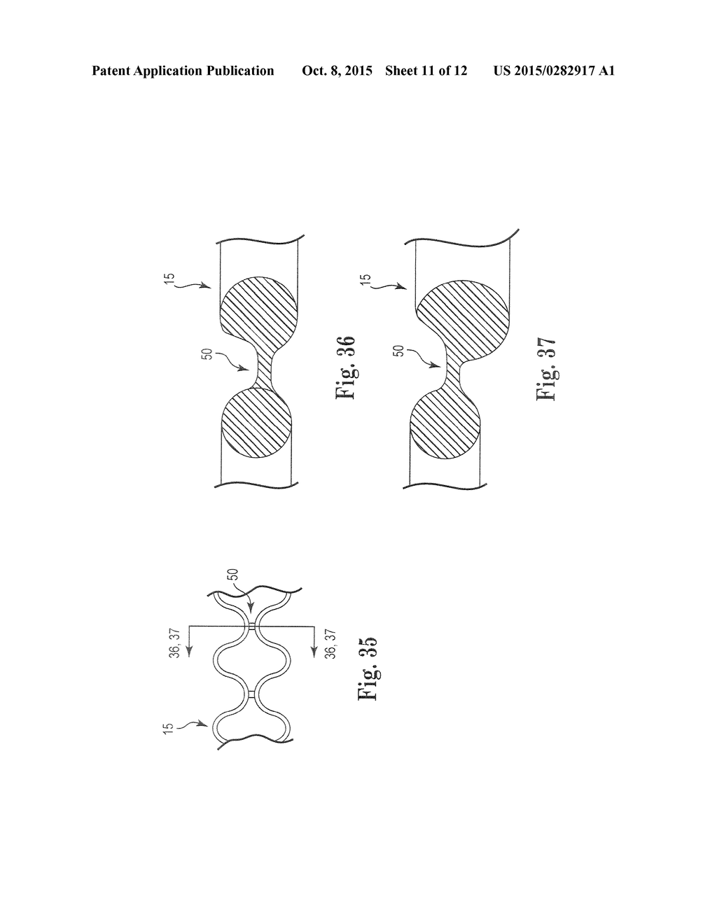 Patterned Sling Implant and Method - diagram, schematic, and image 12