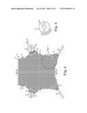 Patterned Implant and Method diagram and image