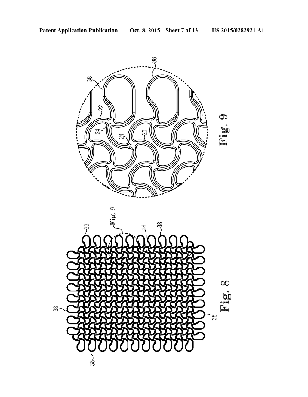 Patterned Implant and Method - diagram, schematic, and image 08