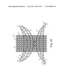 Patterned Implant and Method diagram and image