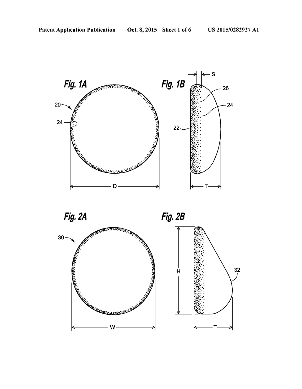 SOFT FILLED PROSTHESIS SHELL WITH DISCRETE FIXATION SURFACES - diagram, schematic, and image 02