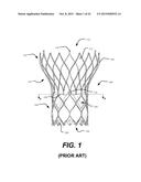 CUFF CONFIGURATIONS FOR PROSTHETIC HEART VALVE diagram and image