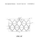 CUFF CONFIGURATIONS FOR PROSTHETIC HEART VALVE diagram and image