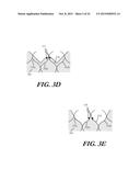 CUFF CONFIGURATIONS FOR PROSTHETIC HEART VALVE diagram and image