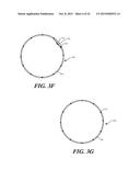 CUFF CONFIGURATIONS FOR PROSTHETIC HEART VALVE diagram and image