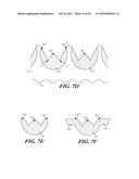 CUFF CONFIGURATIONS FOR PROSTHETIC HEART VALVE diagram and image