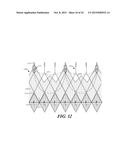 CUFF CONFIGURATIONS FOR PROSTHETIC HEART VALVE diagram and image