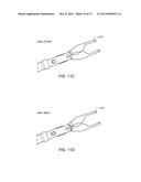 IMPLANT INTERFACE SYSTEM AND DEVICE diagram and image