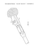 IMPLANT INTERFACE SYSTEM AND DEVICE diagram and image