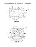 INTERVERTEBRAL SPACERS diagram and image