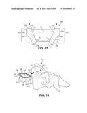 INTERVERTEBRAL SPACERS diagram and image