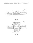 Anchoring Guidewire and Methods for Use diagram and image