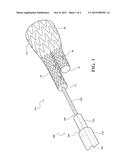 DELIVERY AND DEPLOYMENT SYSTEMS FOR BIFURCATED STENT GRAFTS diagram and image