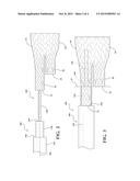 DELIVERY AND DEPLOYMENT SYSTEMS FOR BIFURCATED STENT GRAFTS diagram and image