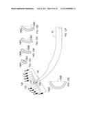 APPARATUS FOR DELIVERING OCULAR IMPLANTS INTO AN ANTERIOR CHAMBER OF THE     EYE diagram and image