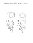 APPARATUS FOR DELIVERING OCULAR IMPLANTS INTO AN ANTERIOR CHAMBER OF THE     EYE diagram and image