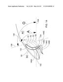 APPARATUS FOR DELIVERING OCULAR IMPLANTS INTO AN ANTERIOR CHAMBER OF THE     EYE diagram and image