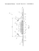 Absorbent Articles Having Zones diagram and image