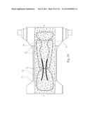 Absorbent Articles Having Zones diagram and image