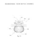 Absorbent Articles Having Zones diagram and image