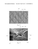 Absorbent Articles Having Zones diagram and image