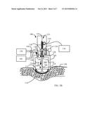 APPARATUS FOR GENERATION OF A PRESSURE PULSE IN TISSUE diagram and image