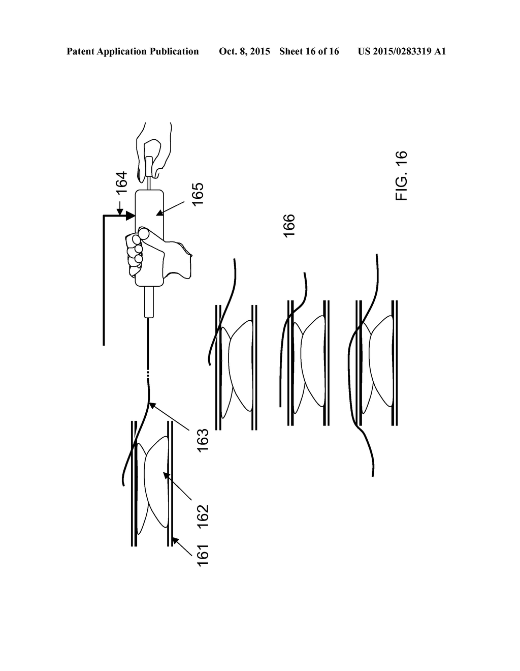 AUTOMATIC CONTRAST-AGENT INJECTION DETECTION - diagram, schematic, and image 17