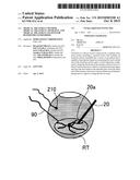 MEDICAL TREATMENT METHOD, MEDICAL TREATMENT APPARATUS, AND MEDICAL     TREATMENT SYSTEM FOR BLOODSTREAM DISORDER diagram and image