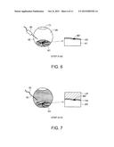 MEDICAL TREATMENT METHOD, MEDICAL TREATMENT APPARATUS, AND MEDICAL     TREATMENT SYSTEM FOR BLOODSTREAM DISORDER diagram and image