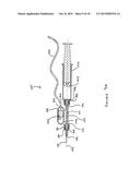 METHOD OF TUNING A VIBRATING MEDICAL DEVICE AND A CONNECTOR FOR THE SAME diagram and image